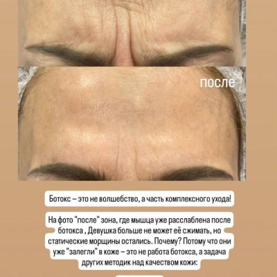 Косметолог постоянно повышающий свою экспертность, искренний специалист Юлия, @NEO_GEO_Beauty