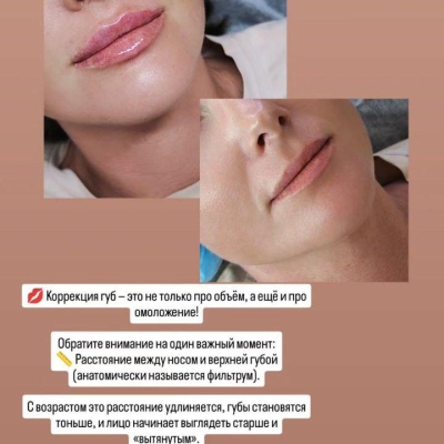 Косметолог постоянно повышающий свою экспертность, искренний специалист Юлия, @NEO_GEO_Beauty