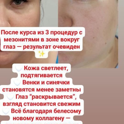 Косметолог постоянно повышающий свою экспертность, искренний специалист Юлия, @NEO_GEO_Beauty