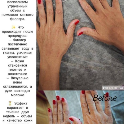 Косметолог постоянно повышающий свою экспертность, искренний специалист Юлия, @NEO_GEO_Beauty