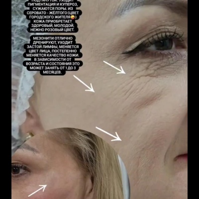 Косметолог постоянно повышающий свою экспертность, искренний специалист Юлия, @NEO_GEO_Beauty