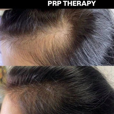 Косметолог постоянно повышающий свою экспертность, искренний специалист Юлия, @NEO_GEO_Beauty