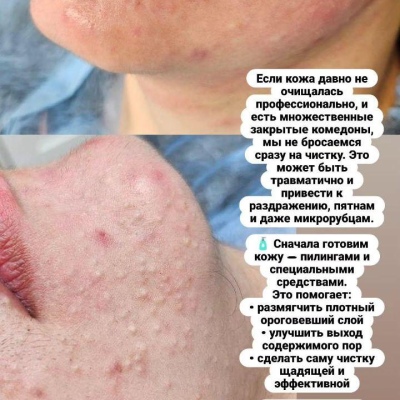 Косметолог постоянно повышающий свою экспертность, искренний специалист Юлия, @NEO_GEO_Beauty